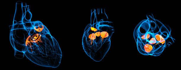 How are Congenital heart defects repaired?
