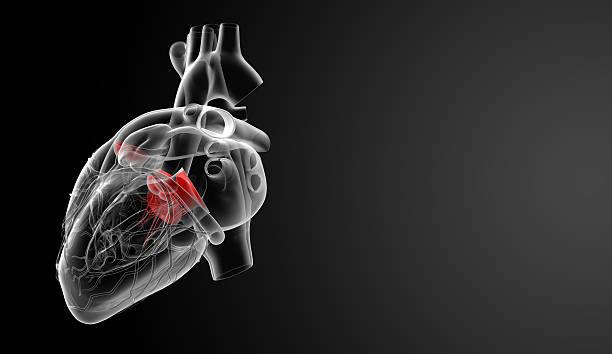 Congenital heart defect repair cost in Iran