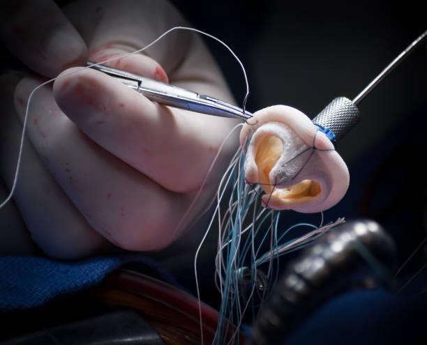 What is Heart Valve surgery?