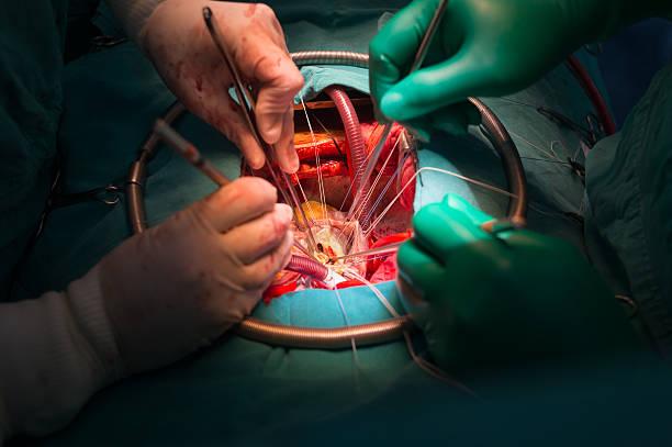 Valve Repair risks & benefits