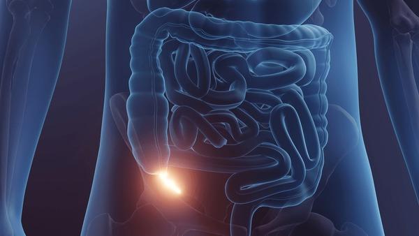 What happens during an Appendectomy?