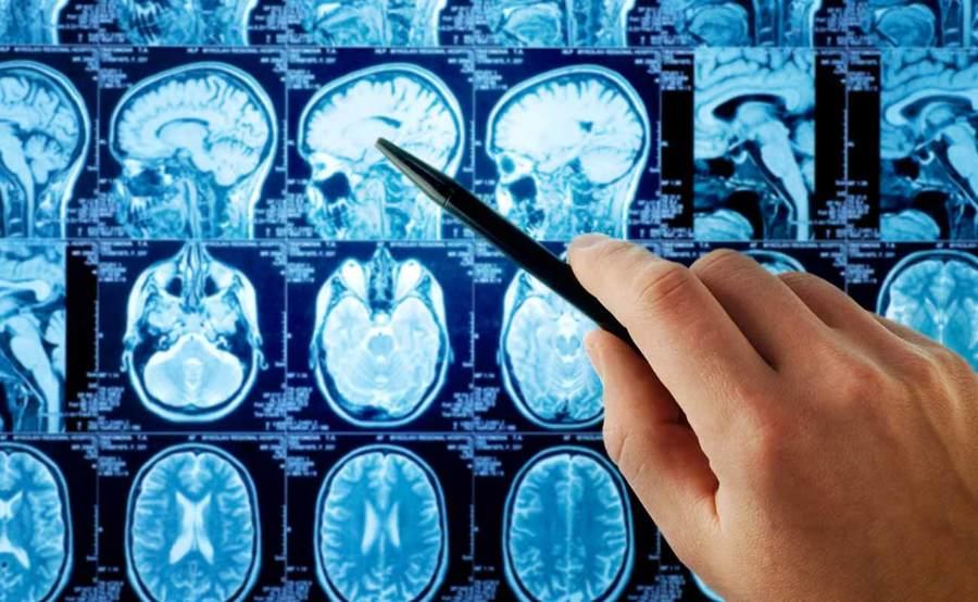 What causes cerebrovascular disease?