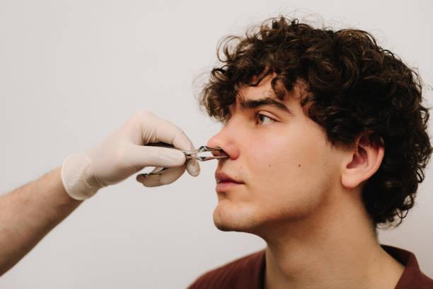 Who needs septoplasty?