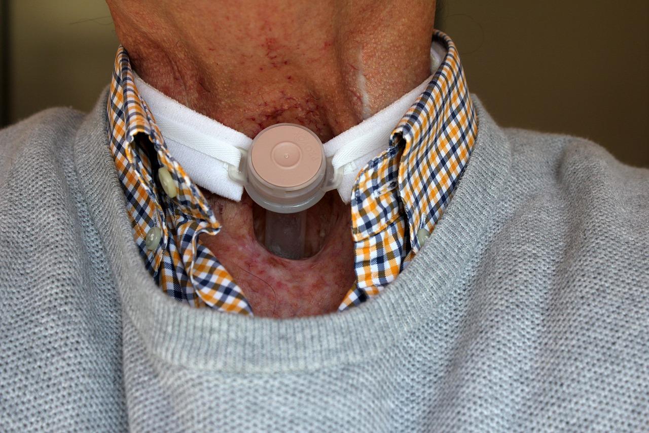 Laryngectomy risks