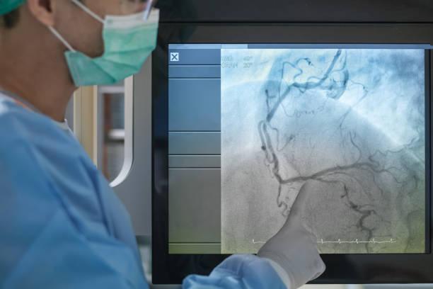 Why is Angiography Required? 