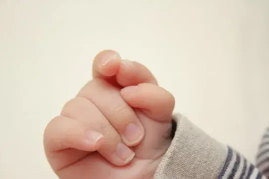 What is Polydactyly? 