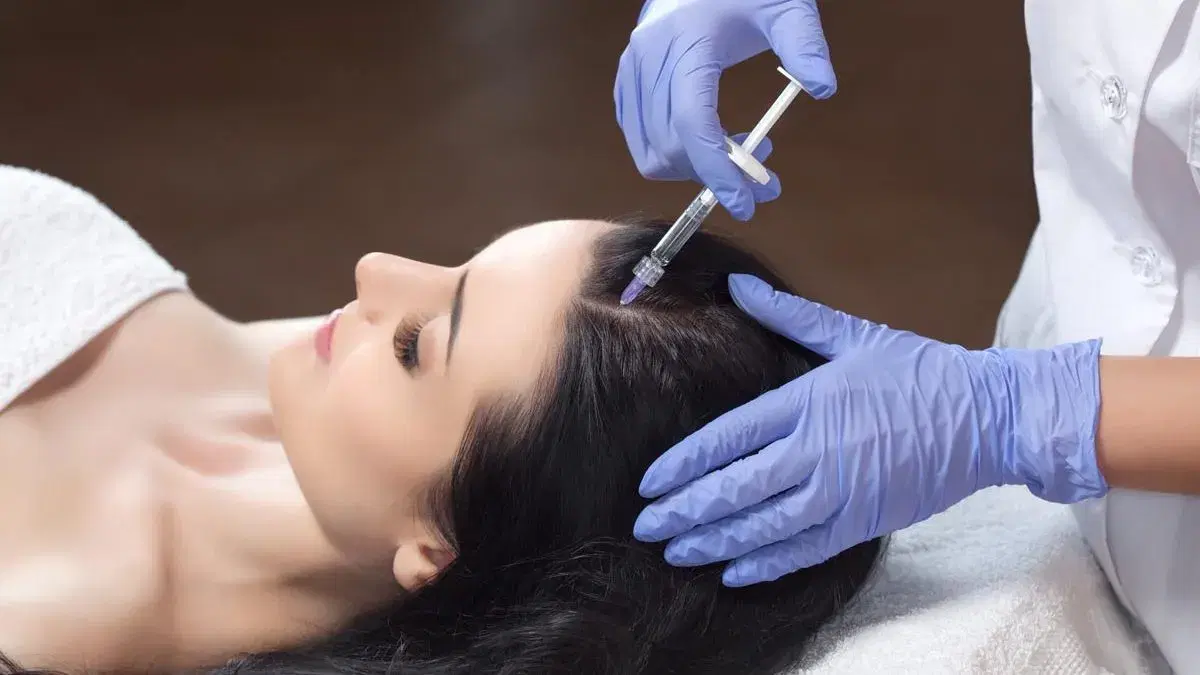 Hair Filler Cost in Iran 