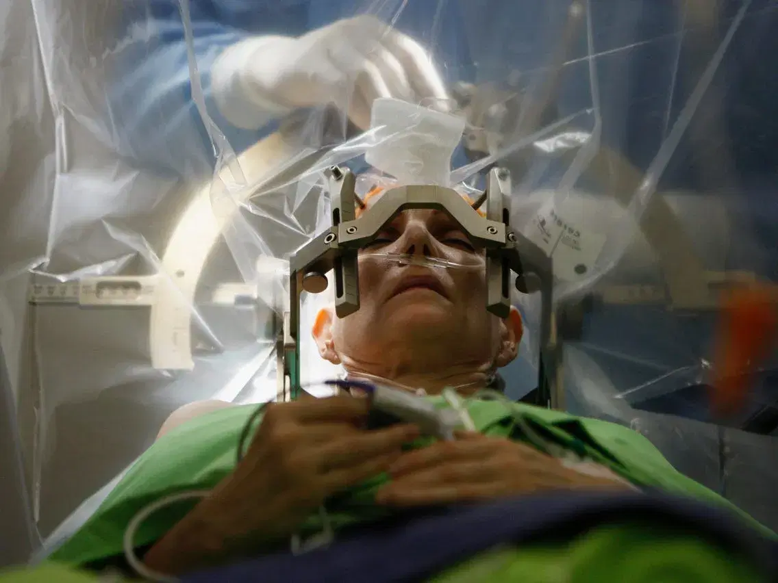 Cost of general brain surgery in Iran