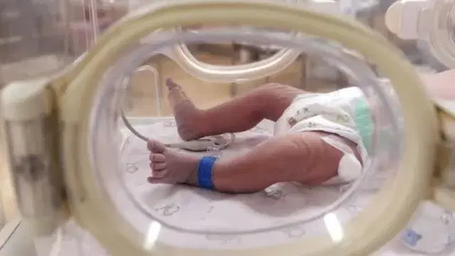 Patent Ductus Arteriosus (PDA)