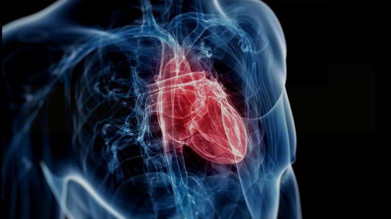 What is Arrhythmia Surgery?