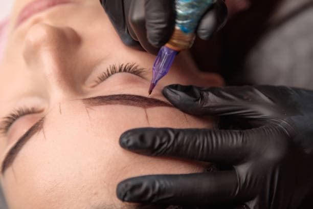 Can eyebrow tattoo be removed?