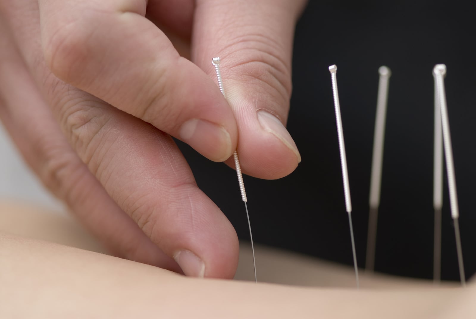 How does Acupuncture work?