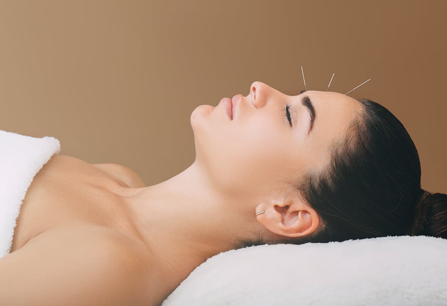 What conditions may be helped by acupuncture?