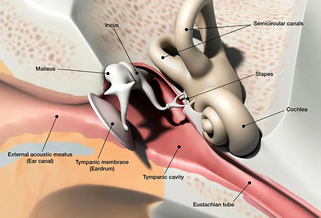 Why would I need a stapedectomy?