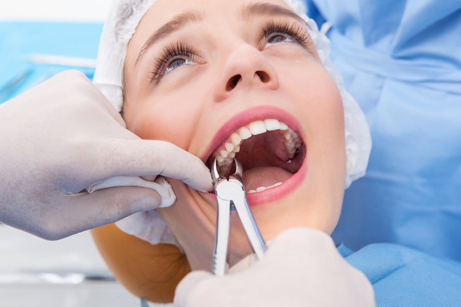 What is tooth extraction?