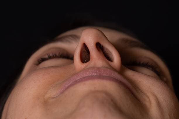 What is a deviated septum?