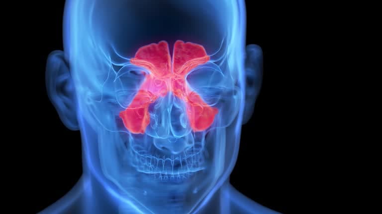 What are the signs and symptoms of sinusitis?