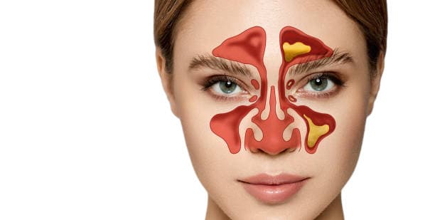 How is a sinus infection diagnosed?