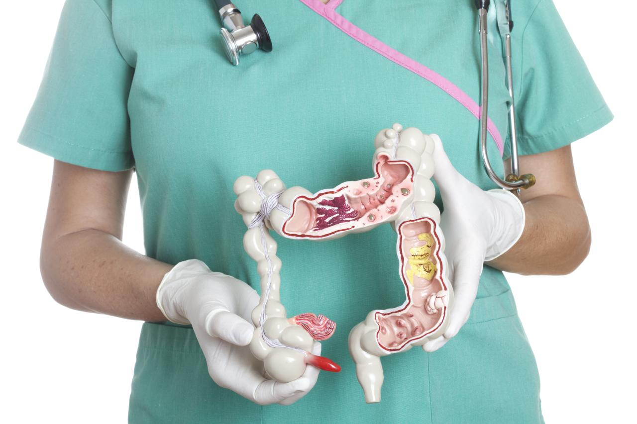 What is appendicitis?