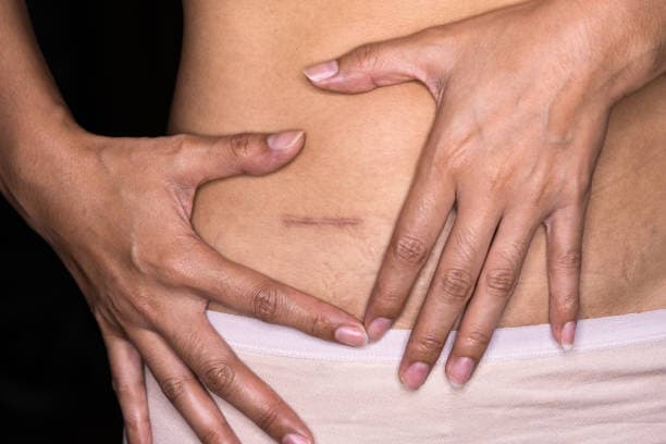 How is appendicitis diagnosed?