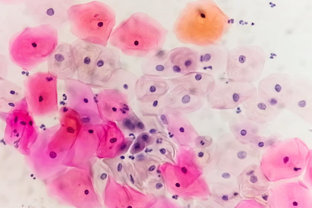 How is HPV prevented?