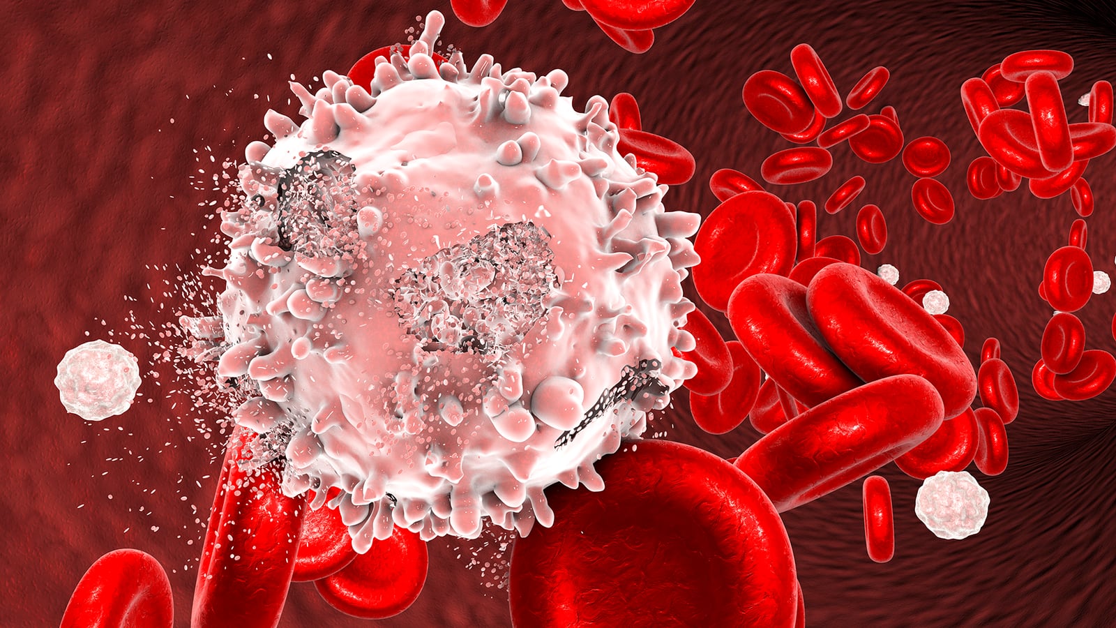 Stem cell transplant vs. bone marrow transplant