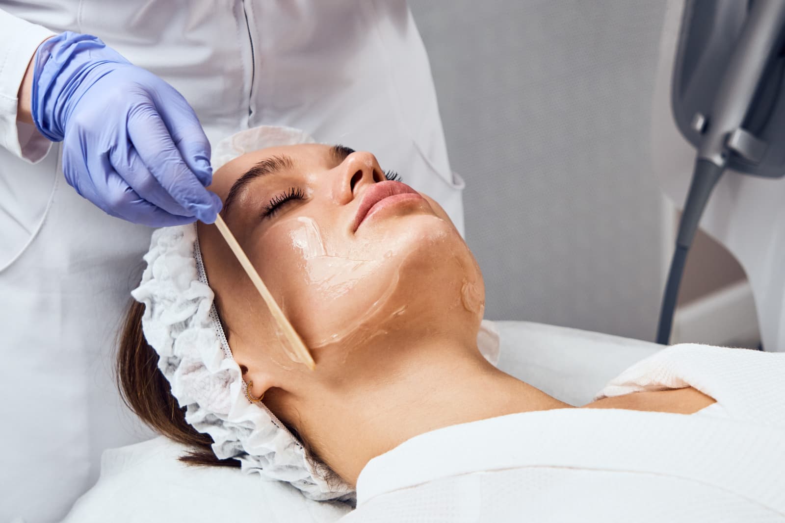 How to prepare for a chemical peel?