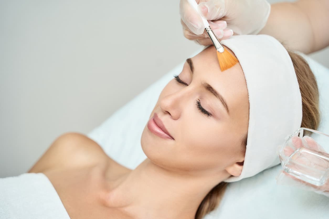 What are the risks of a chemical peel?