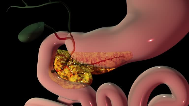 How is pancreatitis treated?