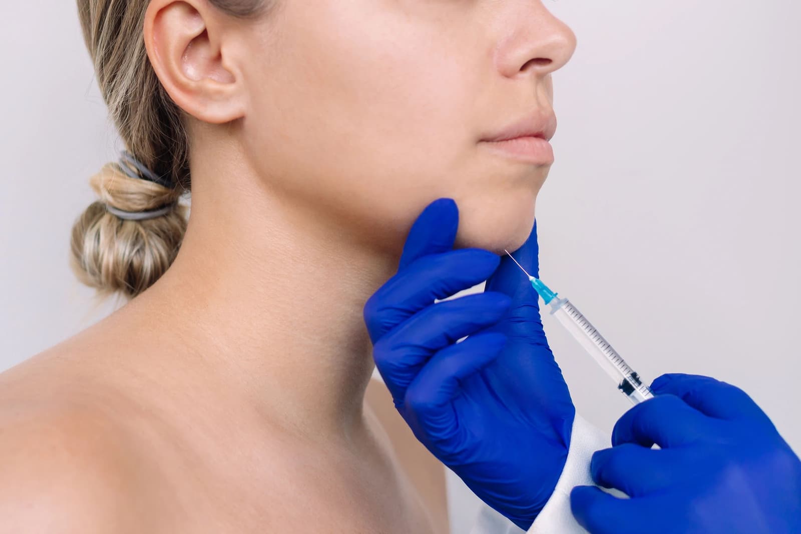 Who is a candidate for Chin Implant?