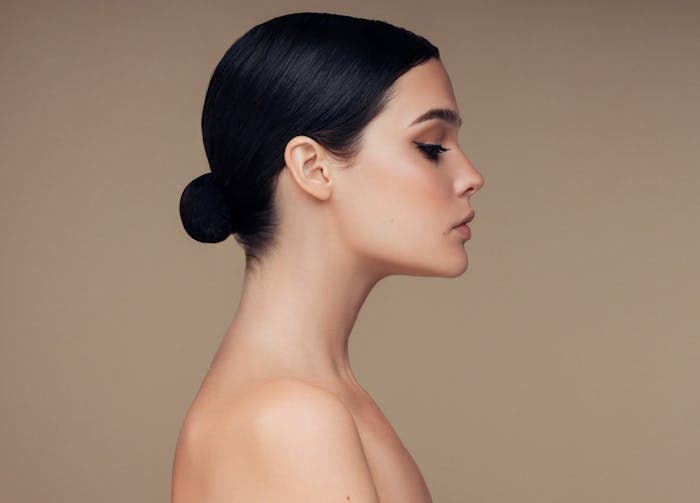 What are the alternatives to a Chin Implant?