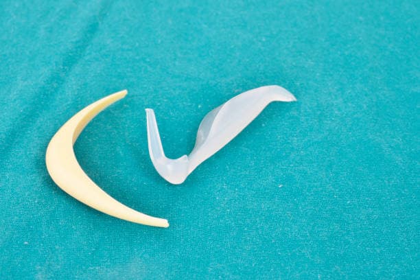 Chin Implant recovery process