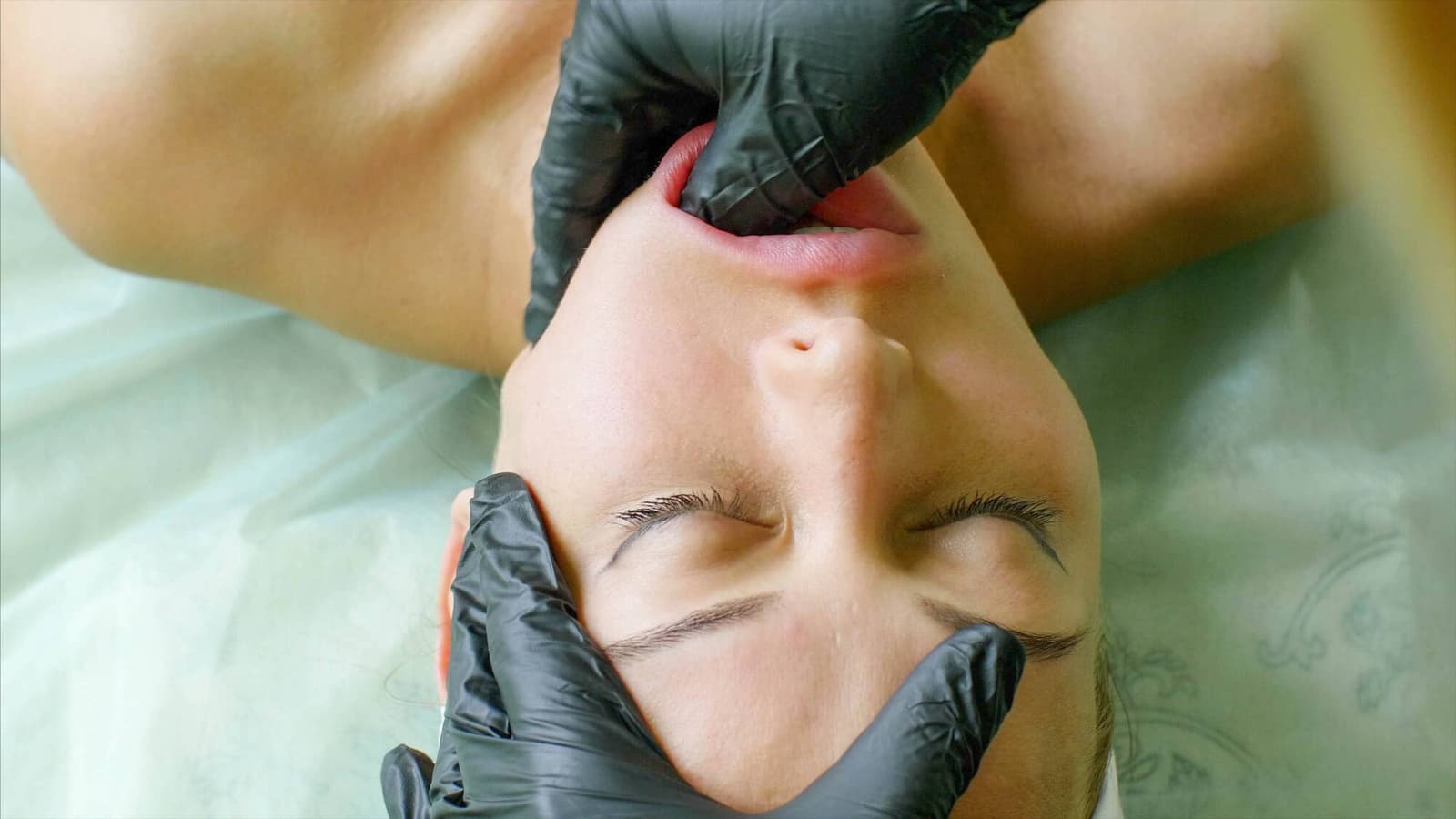 Who is a good candidate for buccal fat removal?