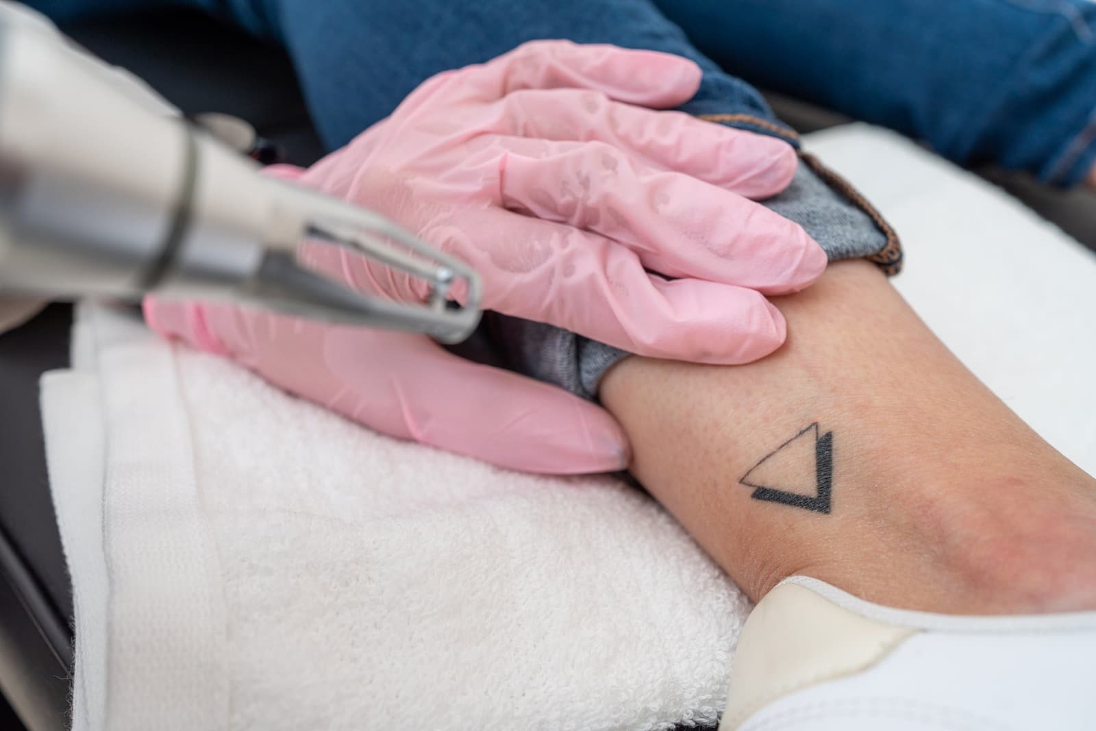 What is tattoo removal?