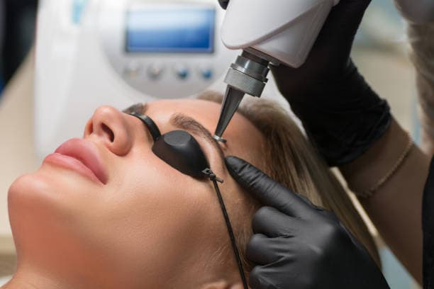 How long does tattoo removal take?