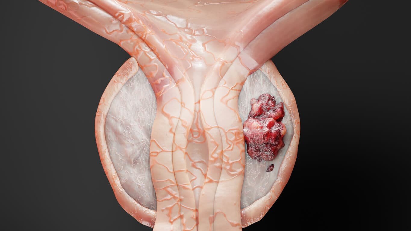 What is the prostate?