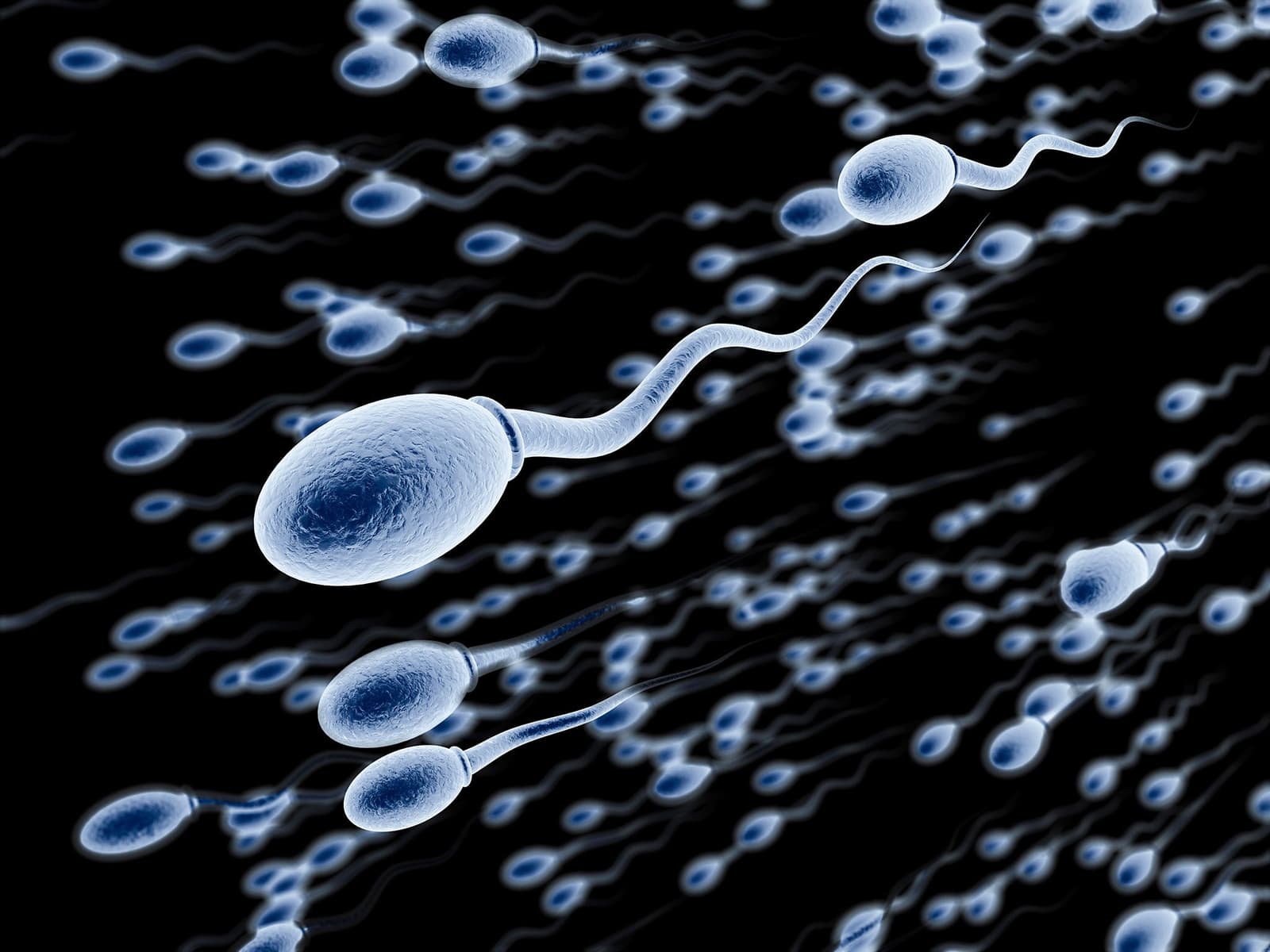 What are the risks & benefits of a vasectomy?