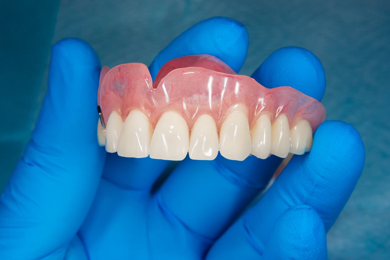 What are dentures?