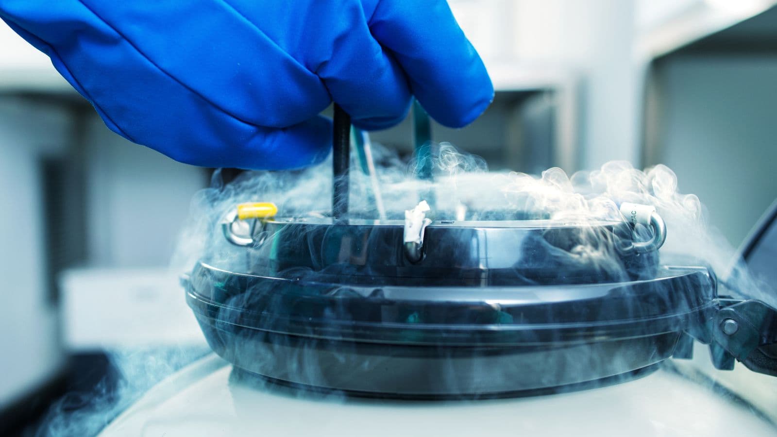 What are the requirements of becoming a sperm donor?