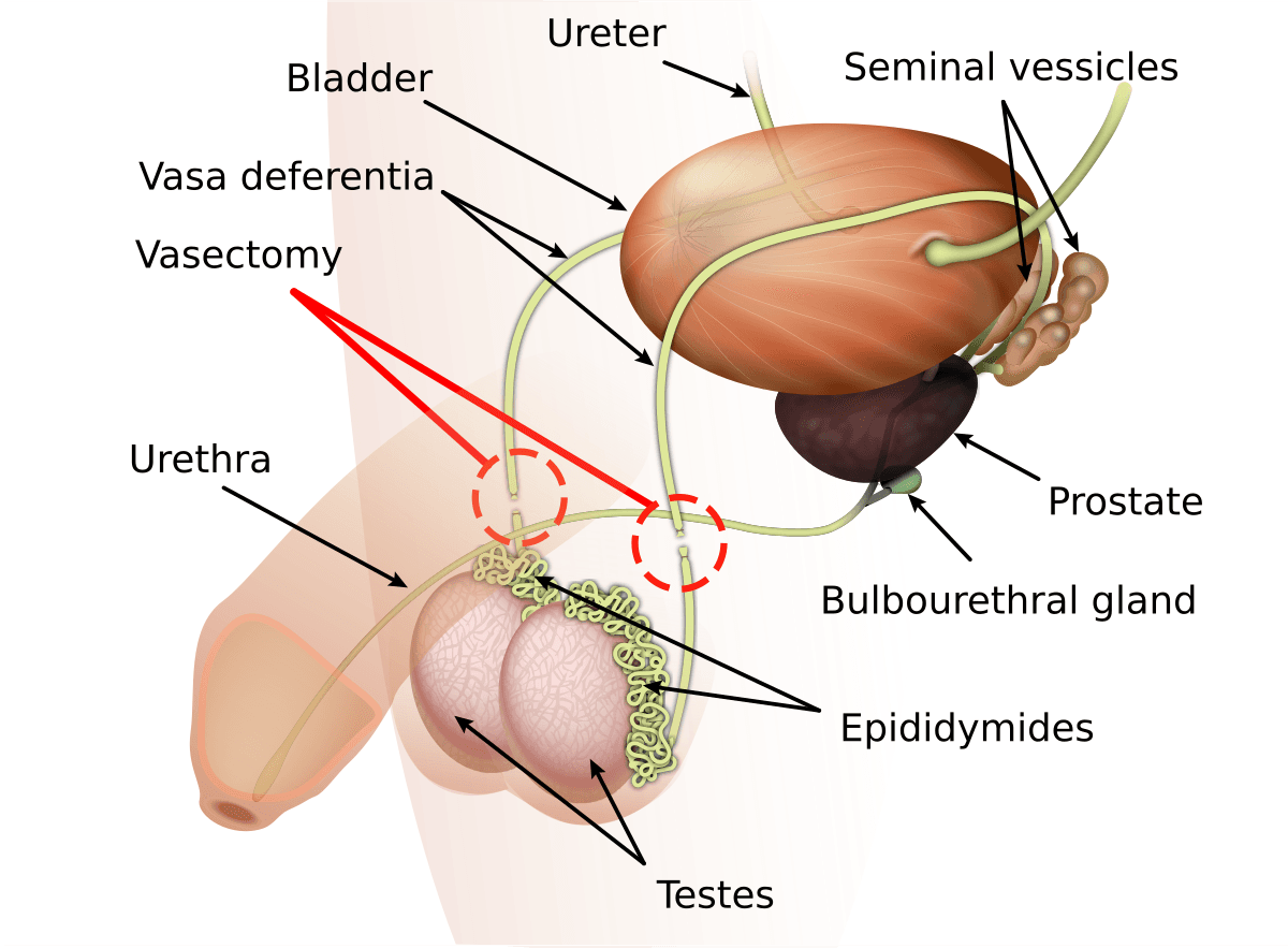 Vasectomy recovery time