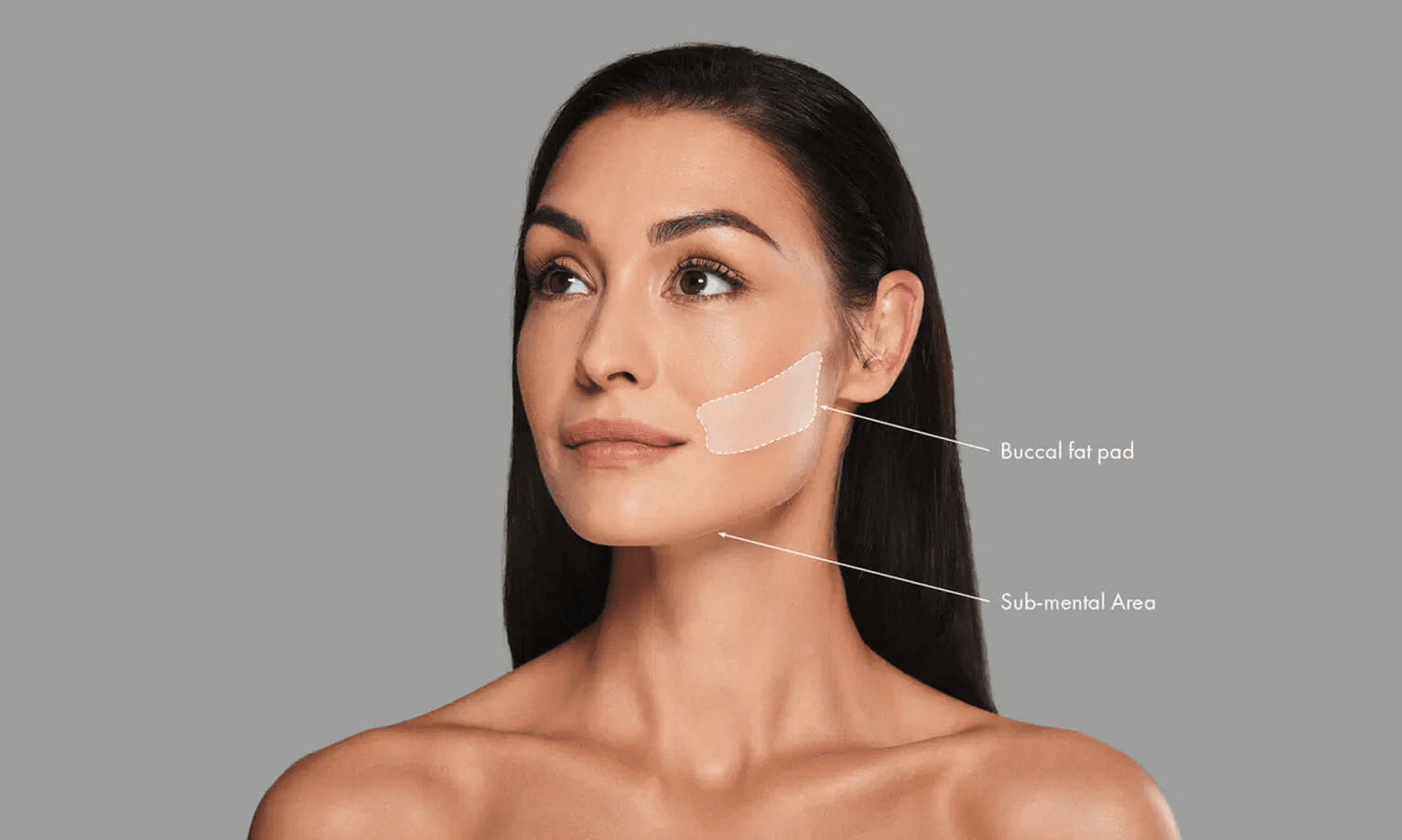 What is a buccal fat removal?