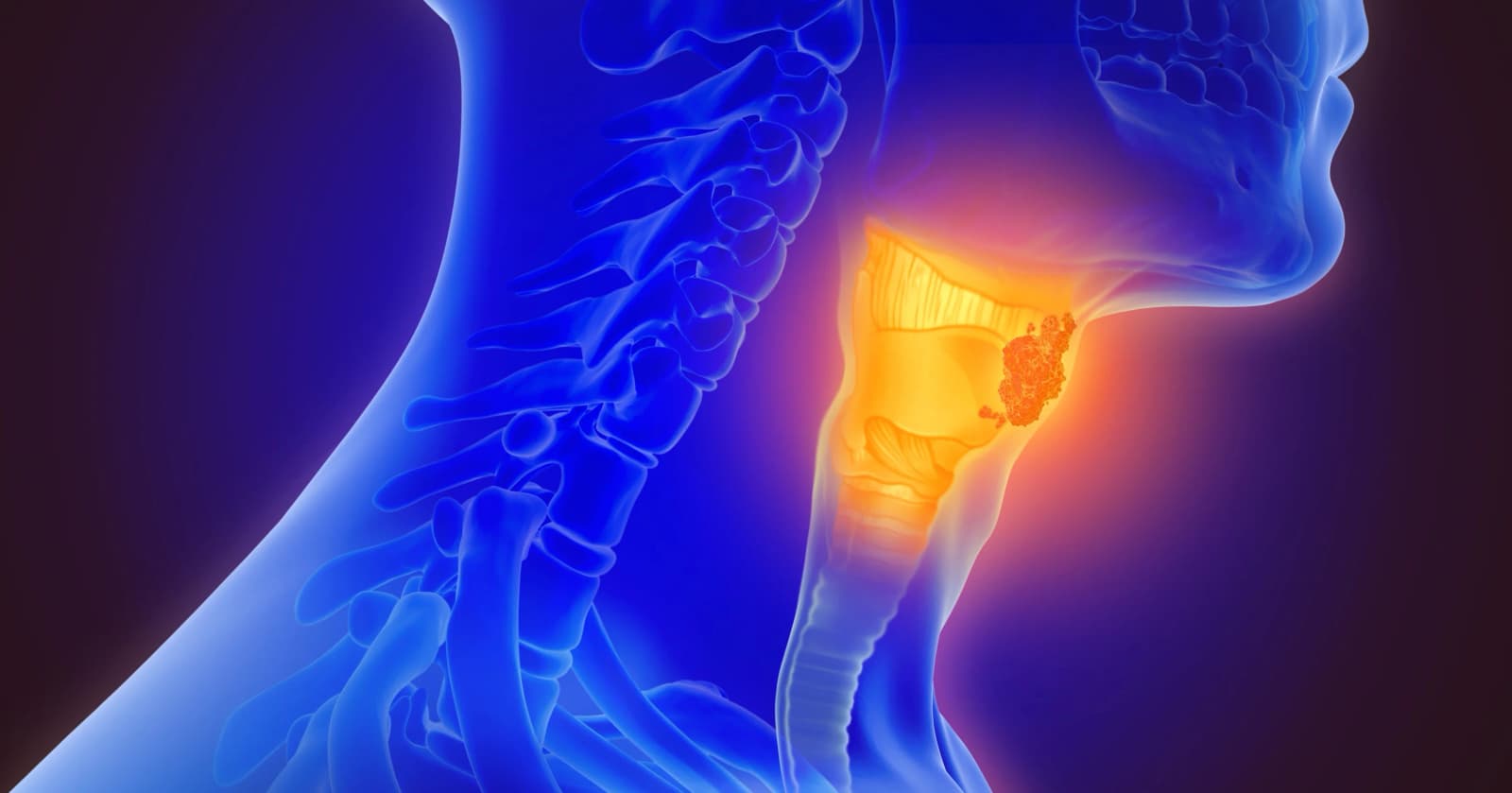 How can I communicate after laryngectomy?