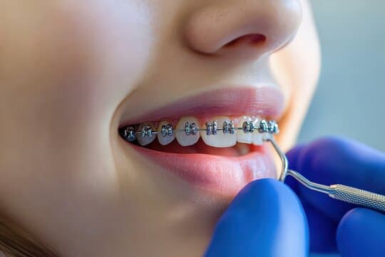 Braces