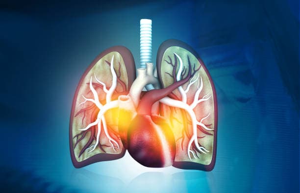 Who needs a lung transplant?
