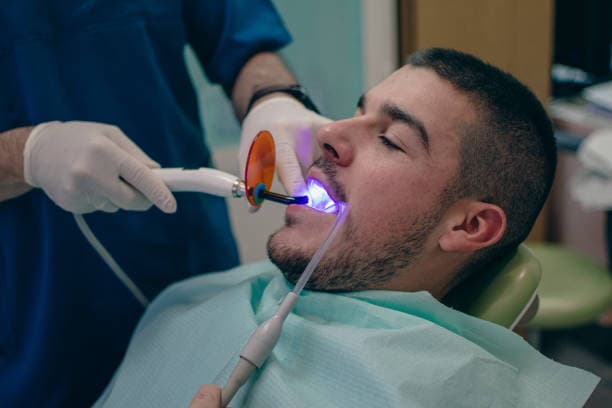 Types of Dental Bonding Treatments