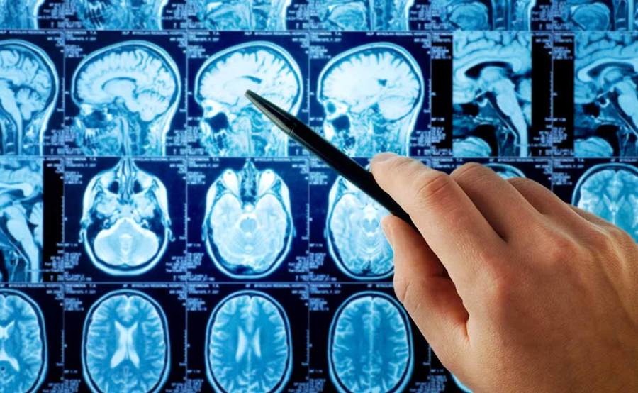 What causes cerebrovascular disease?