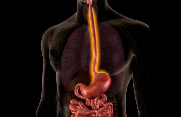 What happens during an Esophagectomy?