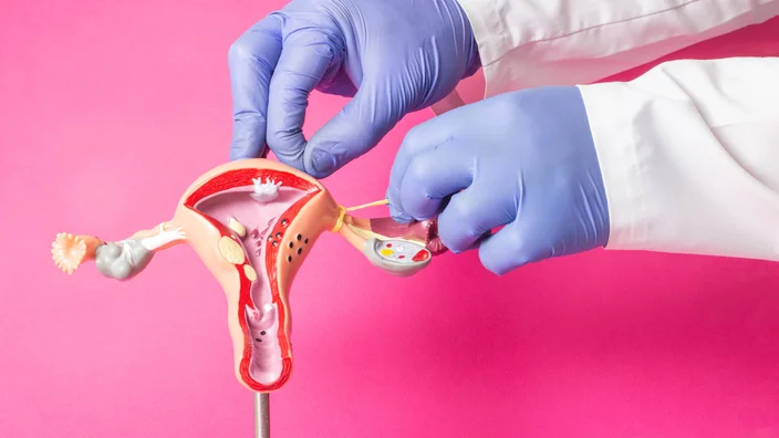 What are female sterilization procedures?