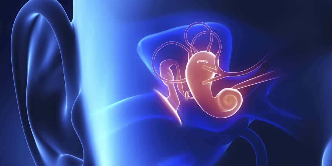 What is myringotomy?