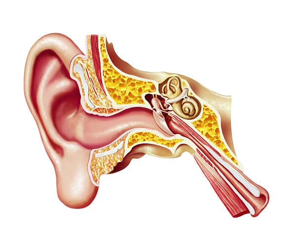 When is a myringotomy necessary?